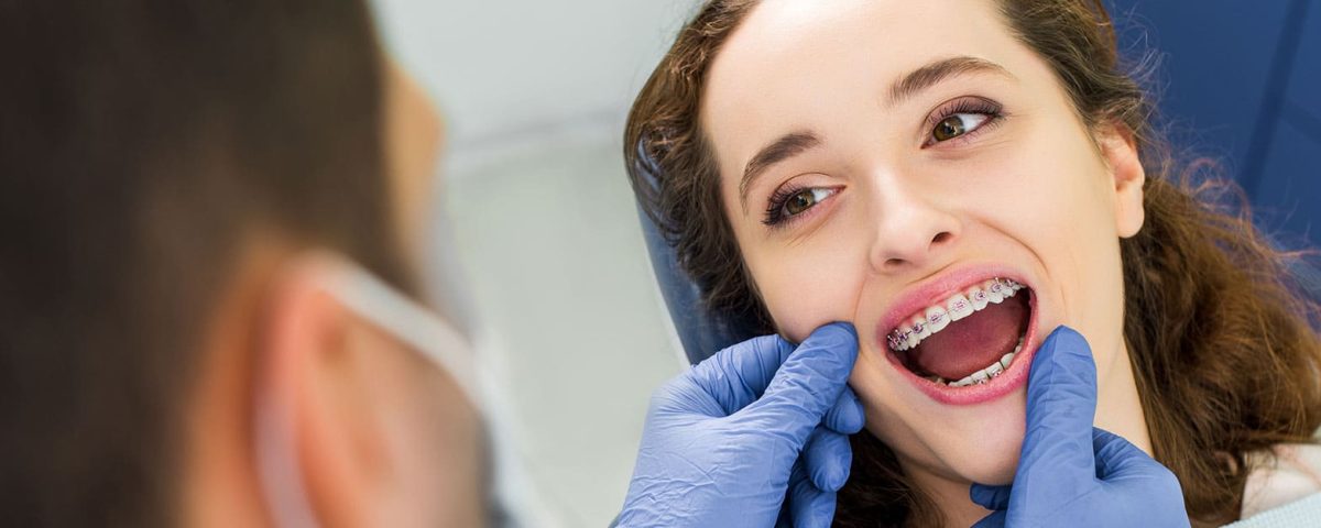 Ortodontik Tedavi | Diş Teli