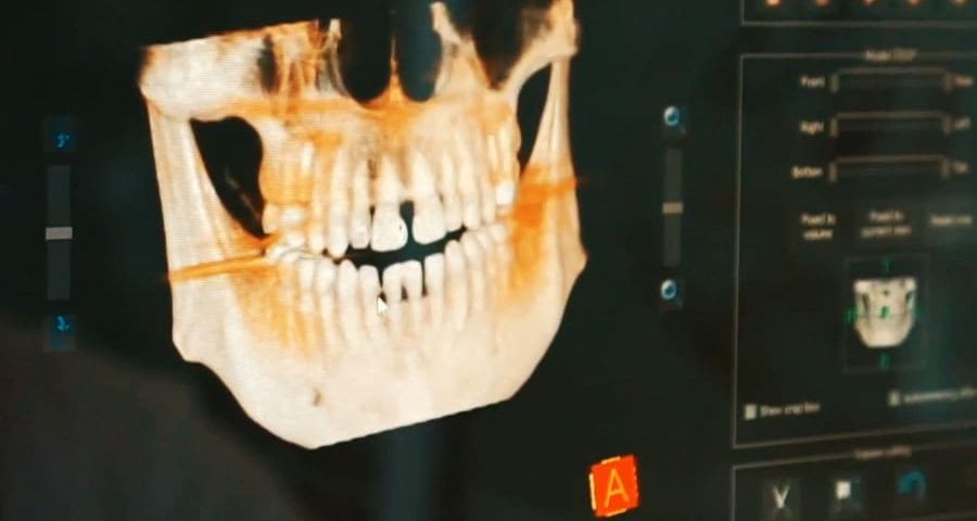 Dental Radyoloji ve Görütüleme