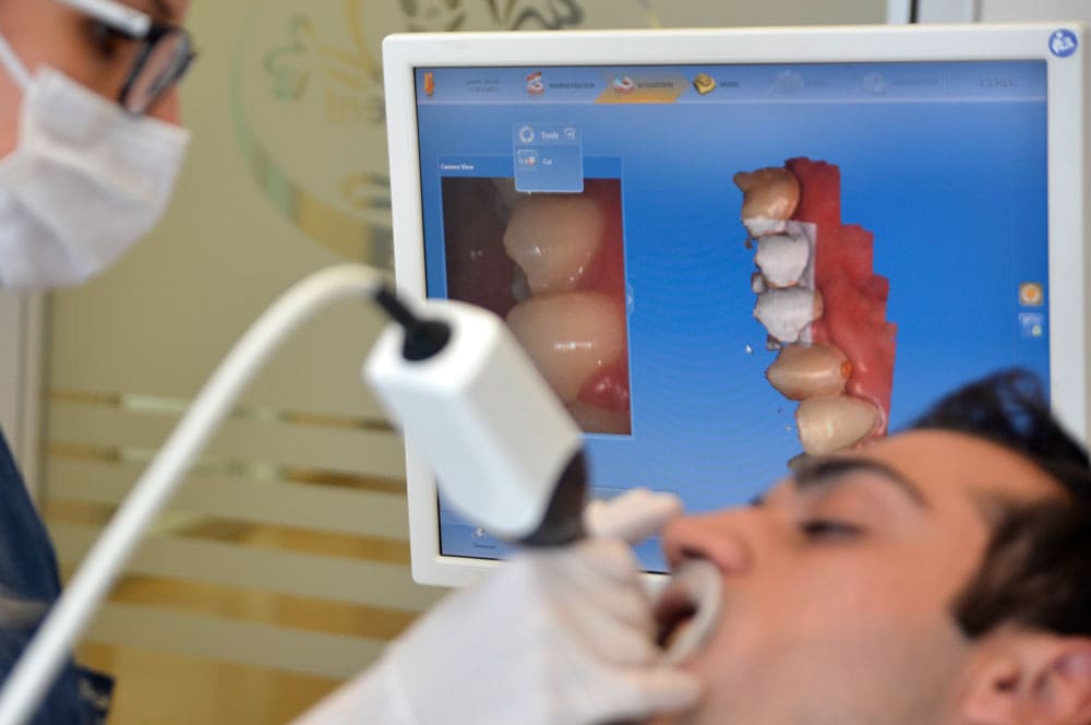 Dijital Ortodonti