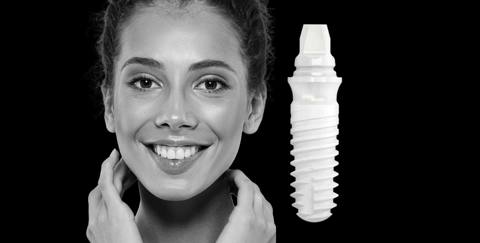 Zirkonyum İmplantlar - Medicadent Ağız ve Diş Sağlığı Polikliniği